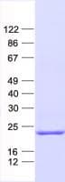 Human NOLA2 Protein (Recombinant His, N-Terminal)