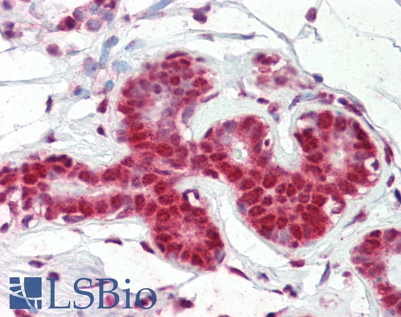 SNRPA / U1A Antibody (aa191-240)
