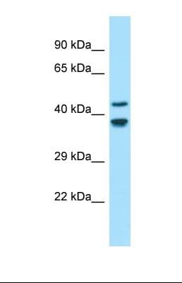 GLDN / Gliomedin Antibody (N-Terminus)