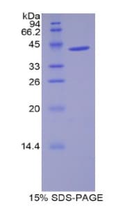 Mouse WFDC5 / PRG5 Protein (Recombinant His-GST)