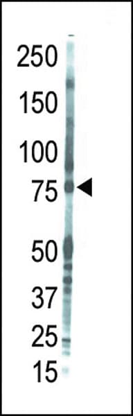 Polyclonal Rabbit anti-Human PRKCQ / PKC-Theta Antibody (aa318-348, IHC, WB)