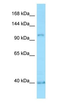 PPP4R1 / PP4R1 Antibody (aa384-433)