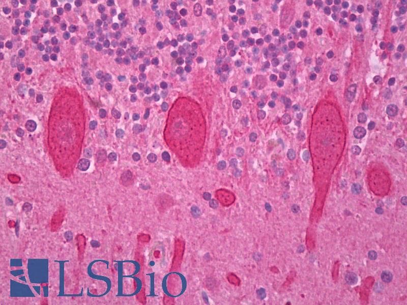 IHC-plus™ PRKCG / PKC-Gamma Antibody