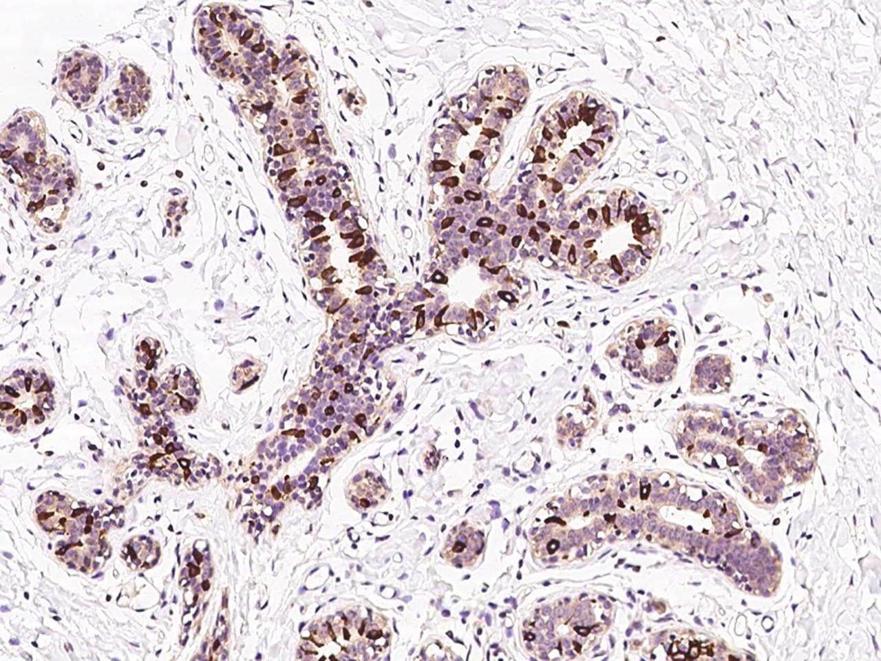 HELO1 / ELOVL5 Antibody