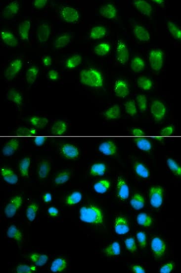 Polyclonal Rabbit anti-Human TLR1 Antibody (IHC, IF, WB)
