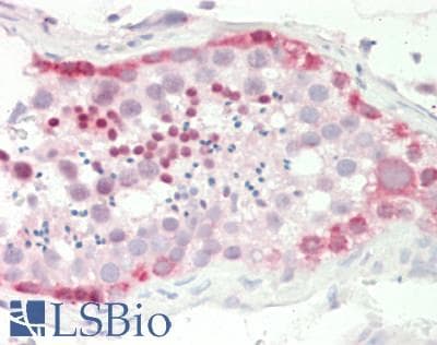 IHC-plus™ Polyclonal Rabbit anti-Human ELAVL4 / HuD Antibody (IHC, IF, WB)