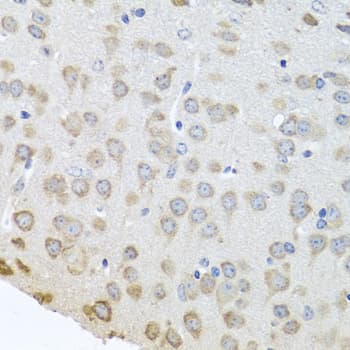 Polyclonal Rabbit anti-Human PABPC4 Antibody (IHC, WB)