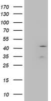 Monoclonal Mouse anti-Human Layilin / LAYN Antibody (clone OTI4C11, WB)
