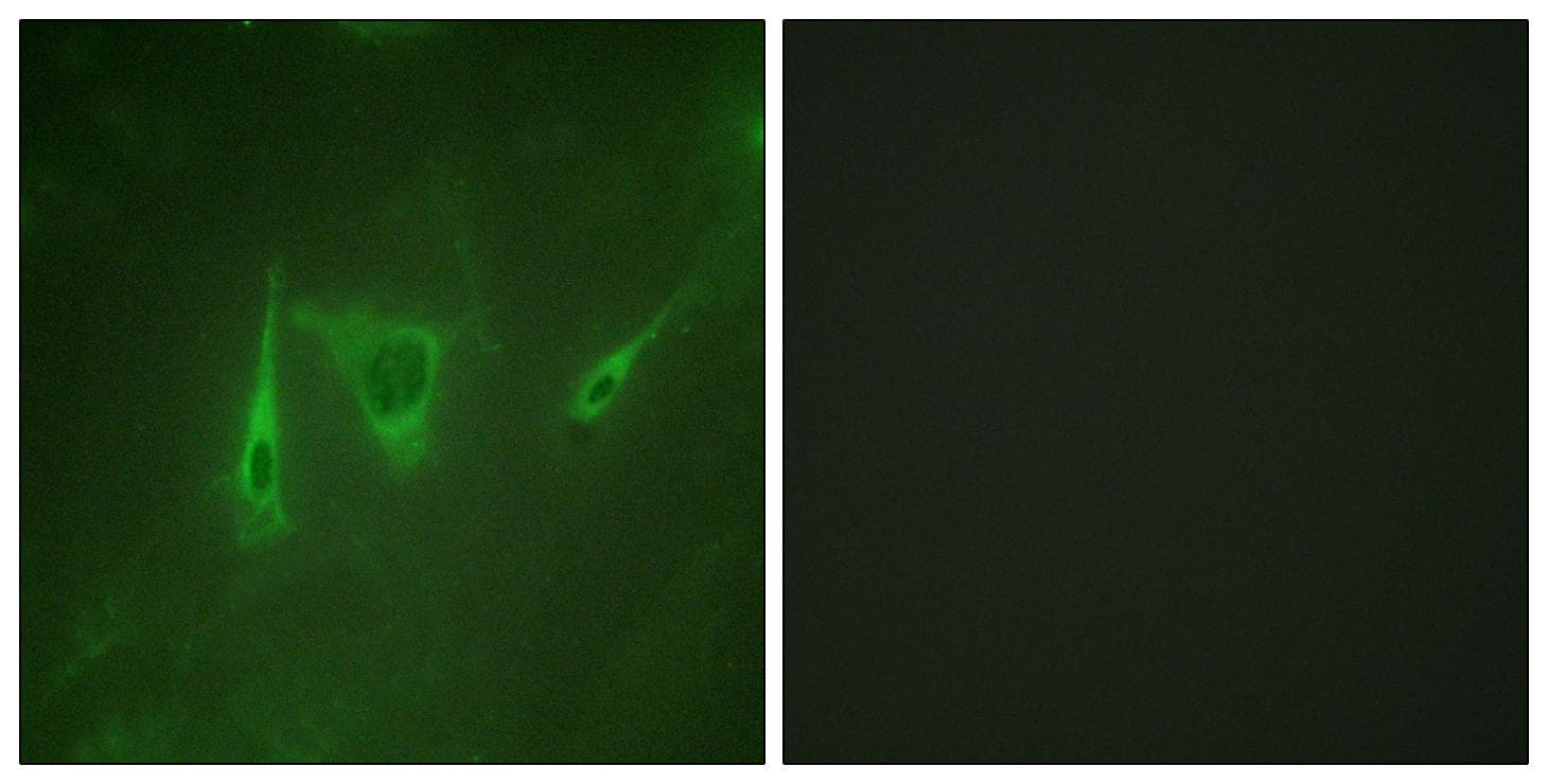 GFAP Antibody (p38)