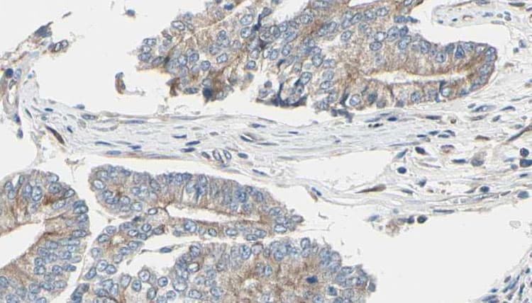 CLASP1 Antibody