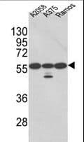 PDIA3 / ERp57 Antibody (aa192-220)