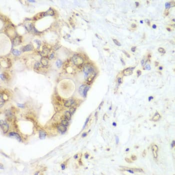 VTI1B Antibody