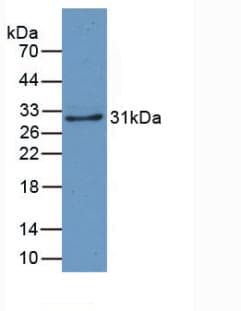 CRY Antibody (aa1-319, PE)