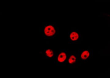 SKP2 Antibody