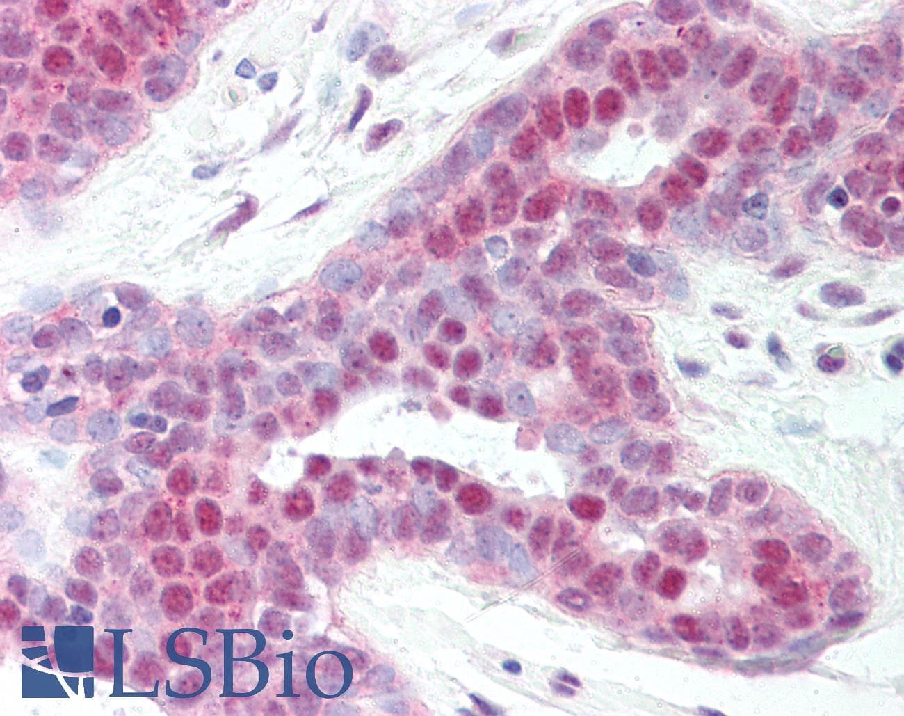 IHC-plus™ RAD50 Antibody (aa628-787)