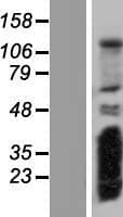 RSG1 Protein (Over-Expression Lysate Myc-DDK (Flag))