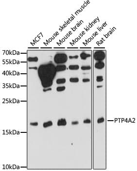 Polyclonal Rabbit anti-Human PTP4A2 / PRL-2 Antibody (WB)