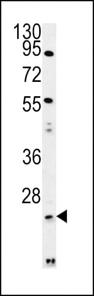 LYPLAL1 Antibody (aa88-117)
