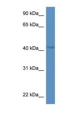 TWF1 / PTK9 Antibody (aa191-240)