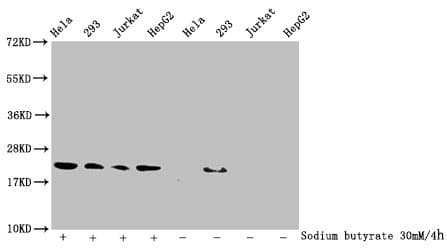 Polyclonal Rabbit anti-Human HIST1H1C Antibody (WB)