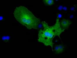 PKLR Antibody (clone OTI1C7)