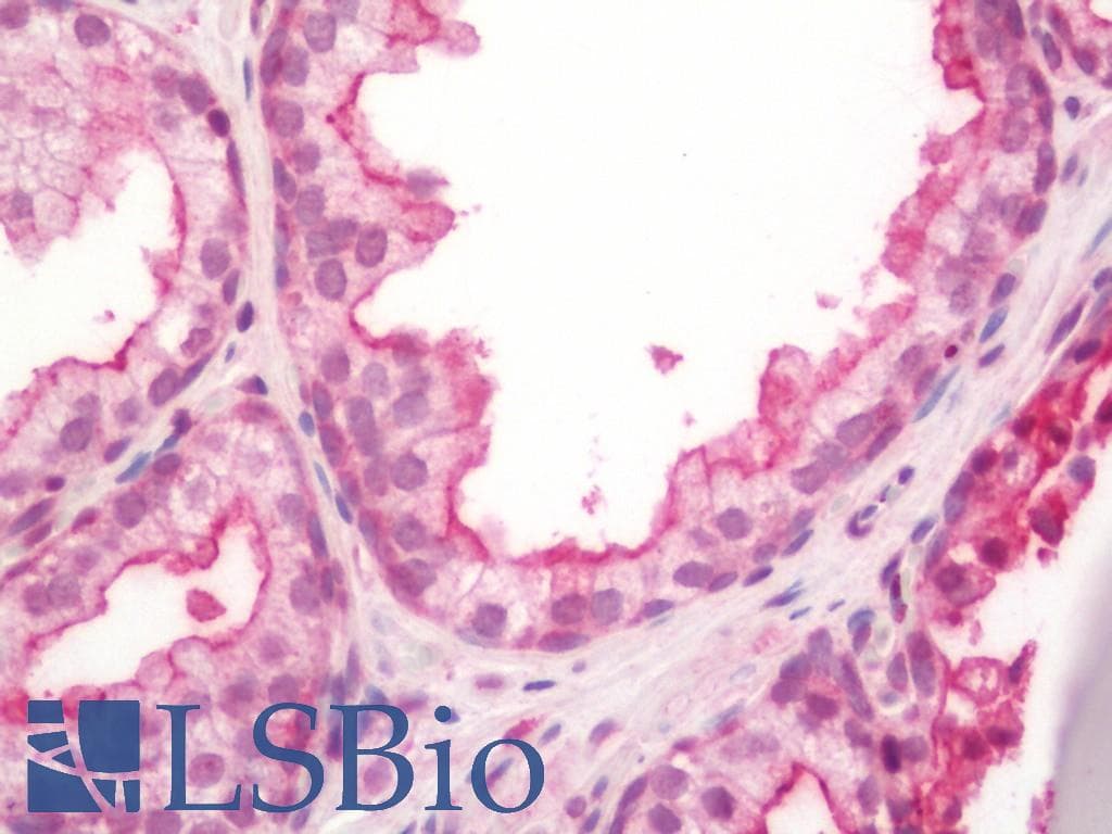 IHC-plus™ Polyclonal Rabbit anti-Human MME / CD10 Antibody (aa274-302, IHC, IF, WB)