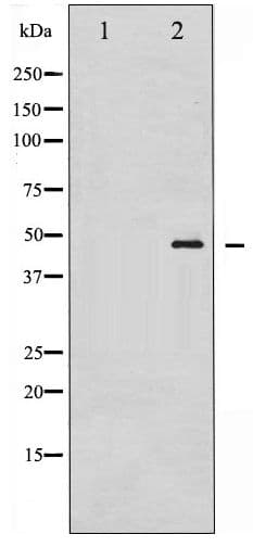 GATA1 Antibody (phospho-Ser142)