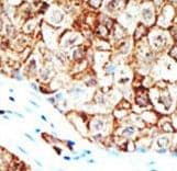 UBQLN1 / Ubiquilin Antibody (aa296-326)