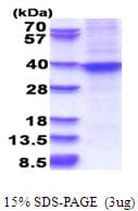 Human HOXA9 Protein (Recombinant His)