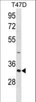 HAVCR2 / TIM-3 Antibody (aa167-194)