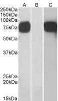 IHC-plus™ GOLM1 / GP73 / GOLPH2 Antibody (aa389-401)