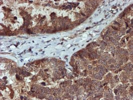 XTP4 / C17orf37 Antibody (clone OTI2D2)