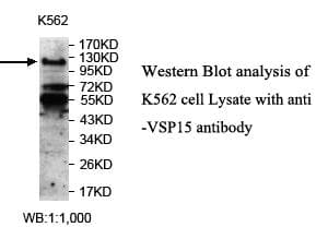 USP15 Antibody (aa48-255)