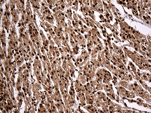 KPNB1 / Importin Beta Antibody (aa1-200, clone OTI6H3)