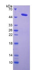 Human LOX / Lysyl Oxidase Protein (Recombinant His-GST, N-terminus)