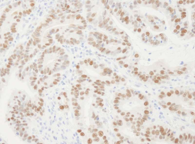 Polyclonal Rabbit anti-Human PCNA Antibody (aa75-125, IHC, WB)