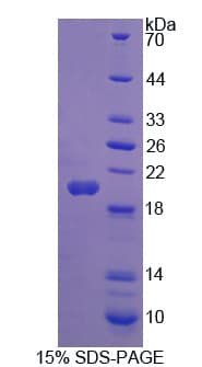 Human THRSP Protein (Recombinant His-T7)