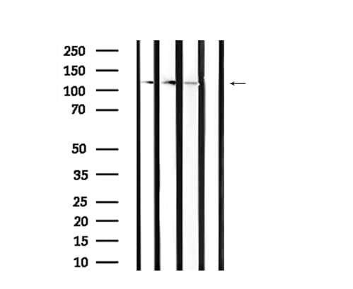 Polyclonal Rabbit anti-Human CLIP2 / CYLN2 Antibody (IF, WB)