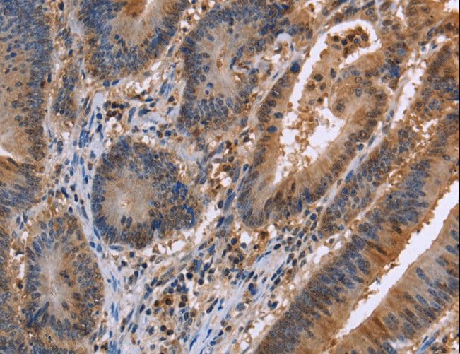 FAAH2 Antibody