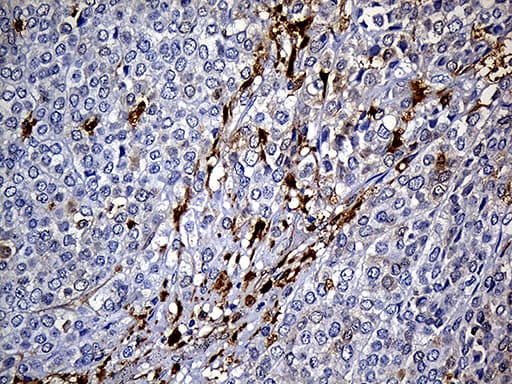M-PST / STM Antibody (clone OTI6A8)
