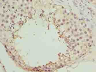 Polyclonal Rabbit anti-Human NICN1 Antibody (IHC, WB)
