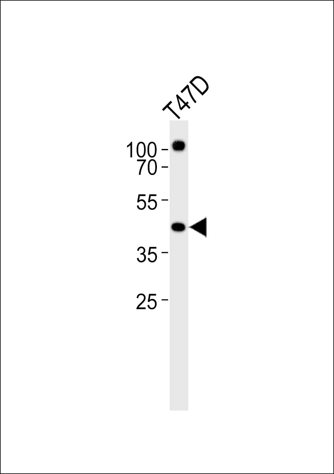 IHC-plus™ RXTA / RXR-Alpha Antibody (aa196-224)