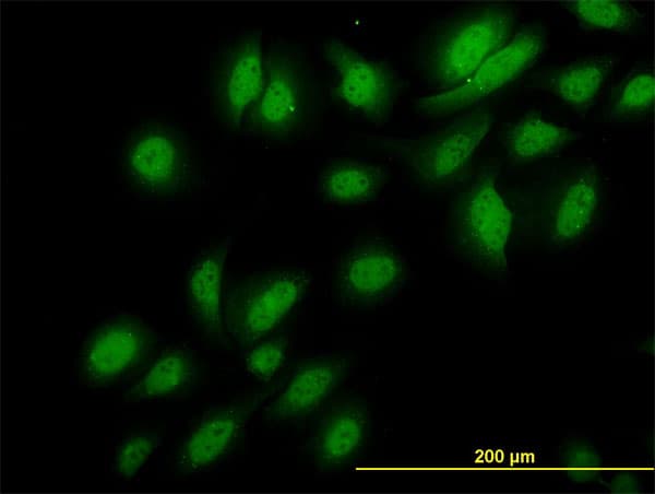 NEK3 Antibody (clone 2F8)