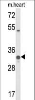 COQ5 Antibody (aa213-241)