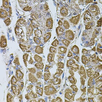 Polyclonal Rabbit anti-Human UQCRC1 Antibody (IHC, WB)