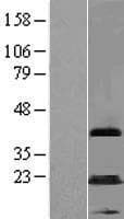 MAGEA5 Protein (Over-Expression Lysate Myc-DDK (Flag))