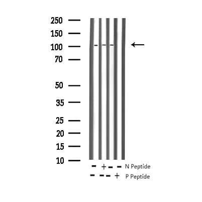 NFKB2 Antibody (phospho-Ser865)