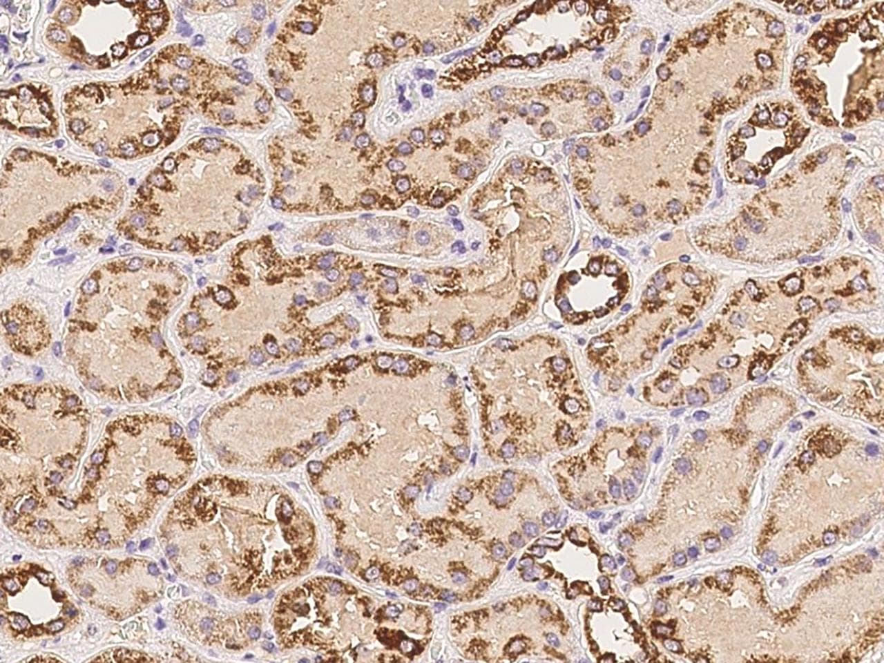 NDUFA3 / B9 Antibody