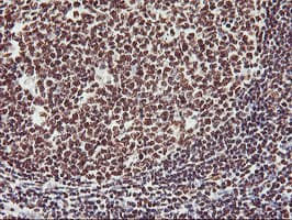 GSTT2 Antibody (clone OTI6C4)