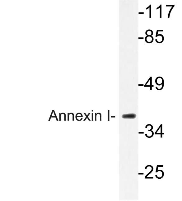 ANXA1 / Annexin A1 Antibody (Asn146)